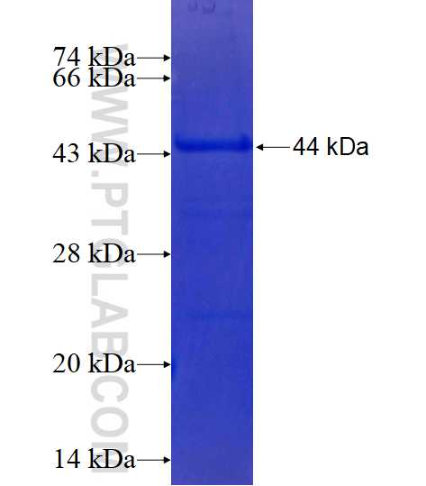 TRPS1 fusion protein Ag16577 SDS-PAGE