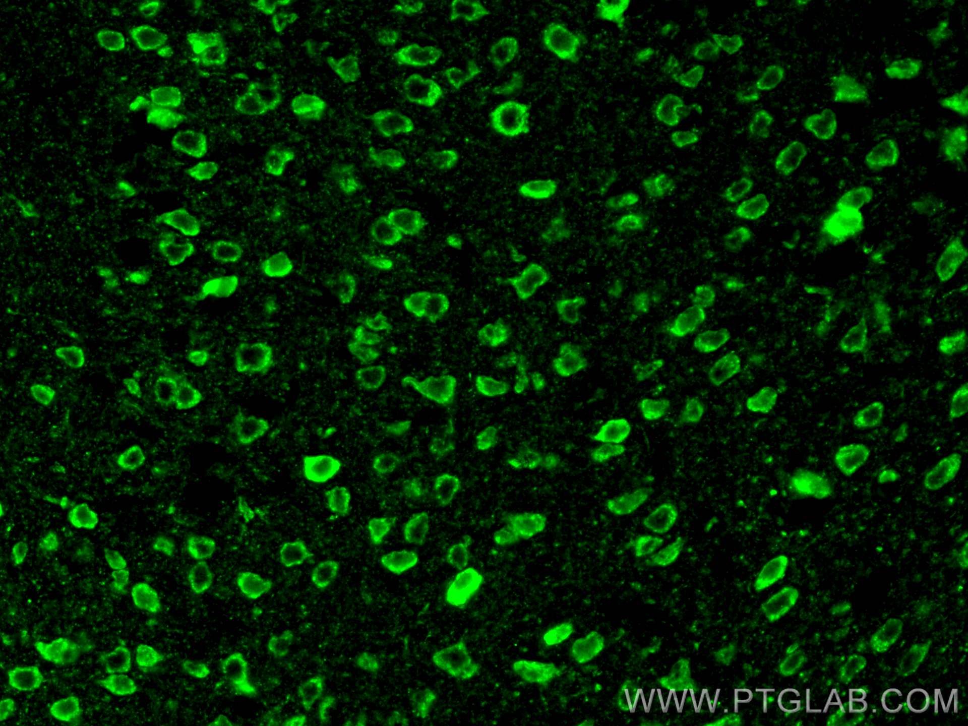 Immunofluorescence (IF) / fluorescent staining of mouse brain tissue using TRPV1 Polyclonal antibody (22686-1-AP)