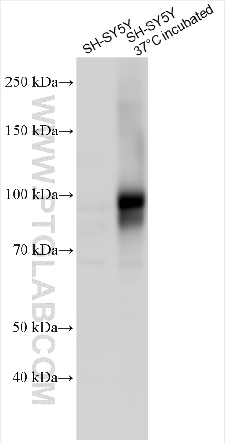 Western Blot (WB) analysis of various lysates using TRPV4 Polyclonal antibody (27892-1-AP)