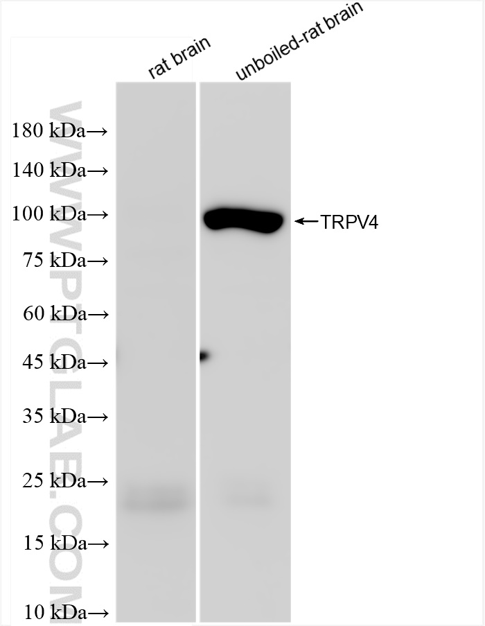 Western Blot (WB) analysis of various lysates using TRPV4 Recombinant antibody (84091-4-RR)