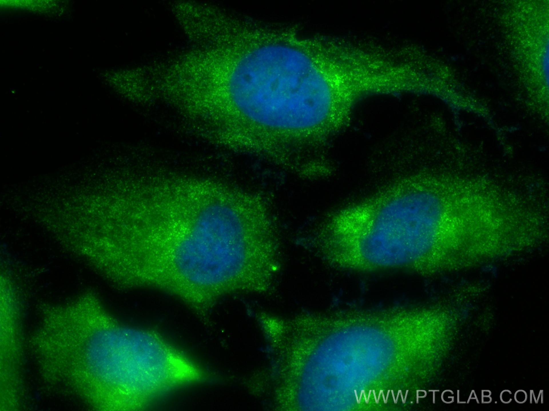 Immunofluorescence (IF) / fluorescent staining of HeLa cells using TRPV6 Polyclonal antibody (13411-1-AP)