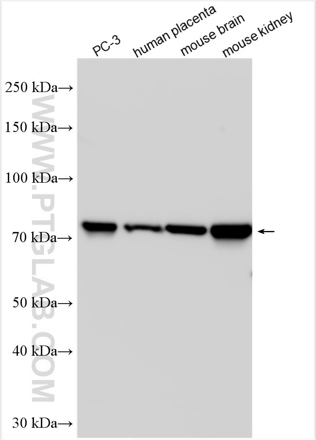 Western Blot (WB) analysis of various lysates using TRPV6 Polyclonal antibody (31045-1-AP)