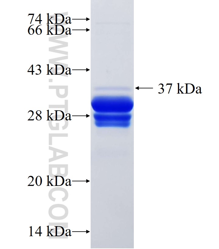 TRPV6 fusion protein Ag34052 SDS-PAGE