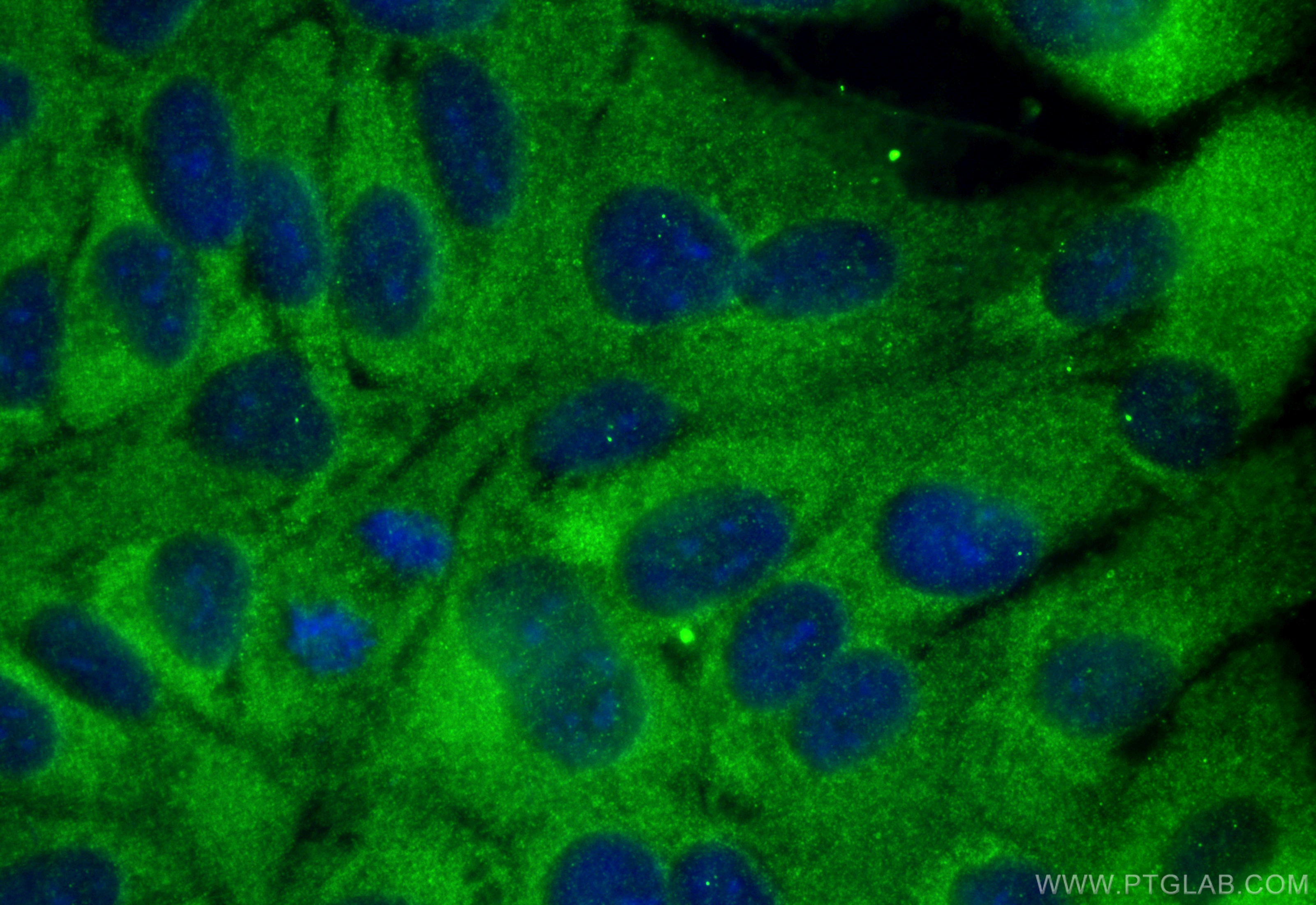 Immunofluorescence (IF) / fluorescent staining of hTERT-RPE1 cells using Hamartin/TSC1 Polyclonal antibody (29906-1-AP)