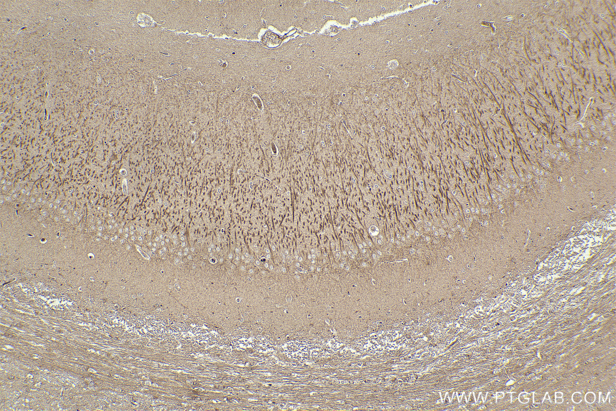 Immunohistochemistry (IHC) staining of rat brain tissue using Tuberin/TSC2 Monoclonal antibody (68380-1-Ig)