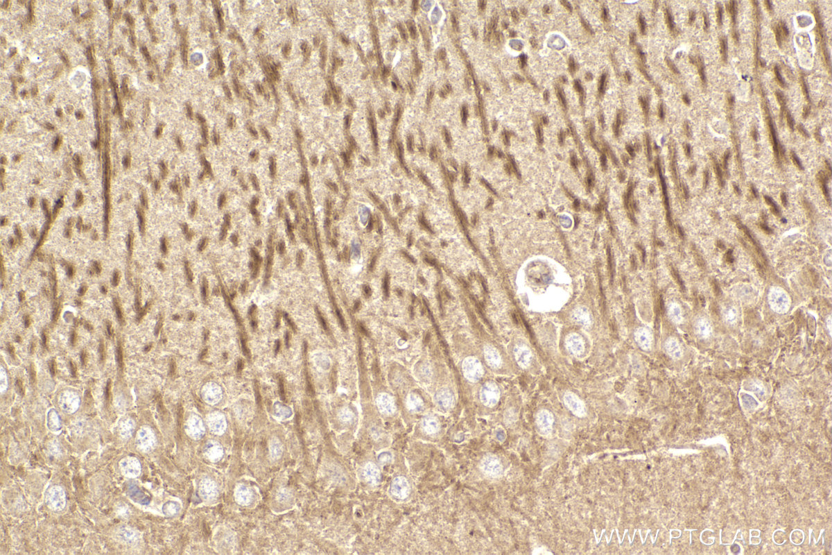 Immunohistochemistry (IHC) staining of rat brain tissue using Tuberin/TSC2 Monoclonal antibody (68380-1-Ig)