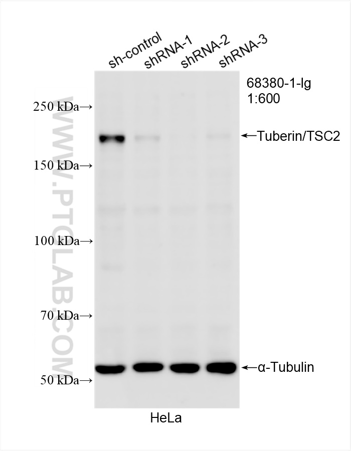 Western Blot (WB) analysis of HeLa cells using Tuberin/TSC2 Monoclonal antibody (68380-1-Ig)