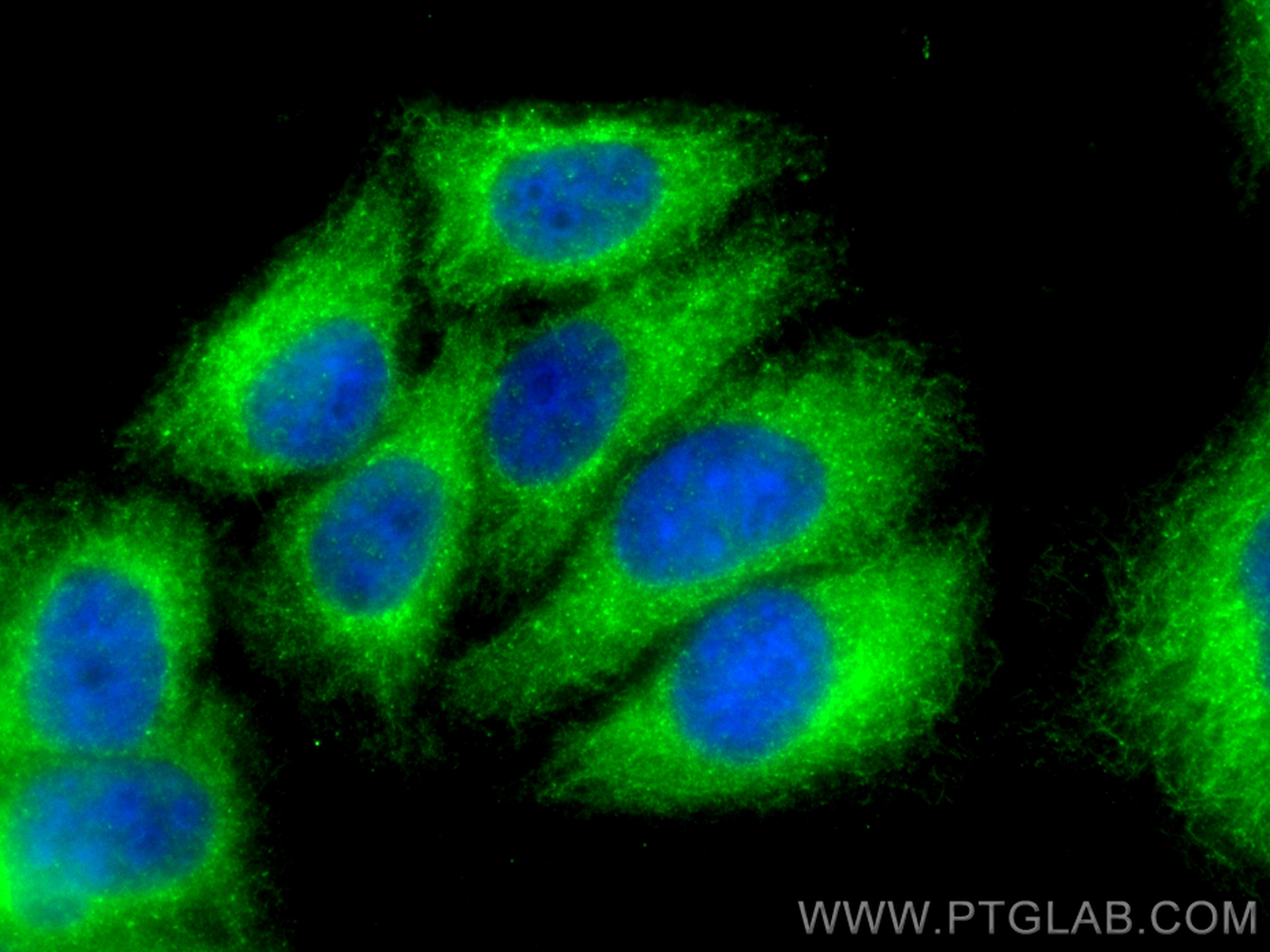 Immunofluorescence (IF) / fluorescent staining of HepG2 cells using TSC22D2 Polyclonal antibody (25418-1-AP)