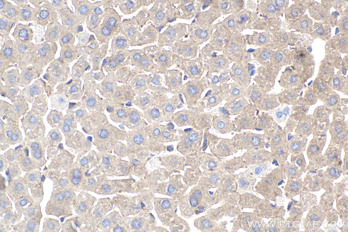 Immunohistochemistry (IHC) staining of mouse liver tissue using GILZ Polyclonal antibody (12352-1-AP)