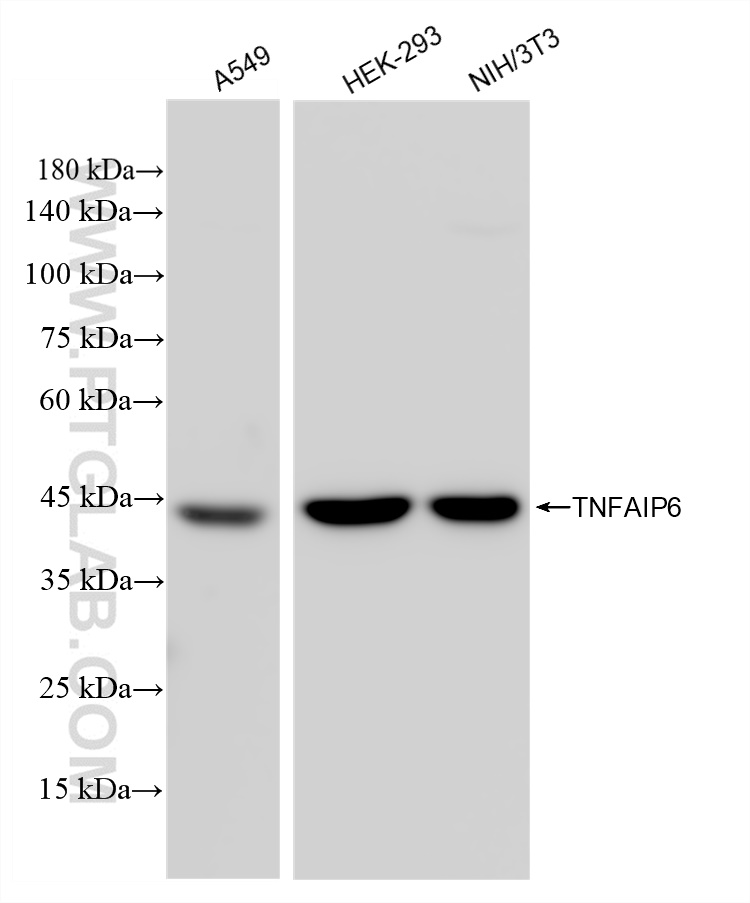 Western Blot (WB) analysis of various lysates using TSG-6 Recombinant antibody (83163-4-RR)