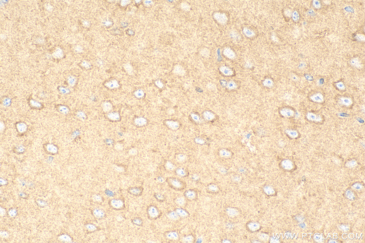 Immunohistochemistry (IHC) staining of mouse brain tissue using TSG101 Polyclonal antibody (28283-1-AP)