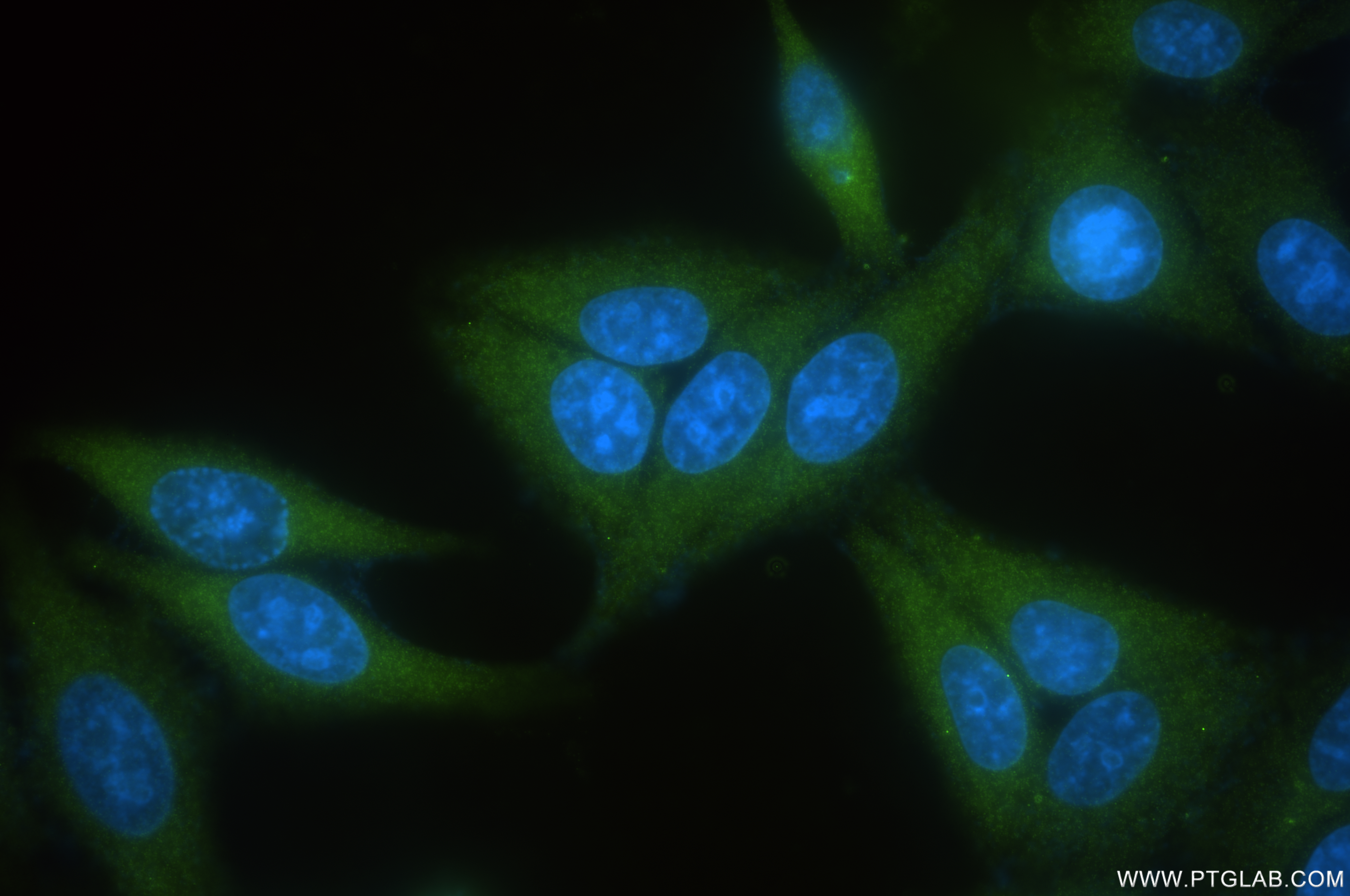 Immunofluorescence (IF) / fluorescent staining of HeLa cells using TSG101 Recombinant antibody (84334-4-RR)