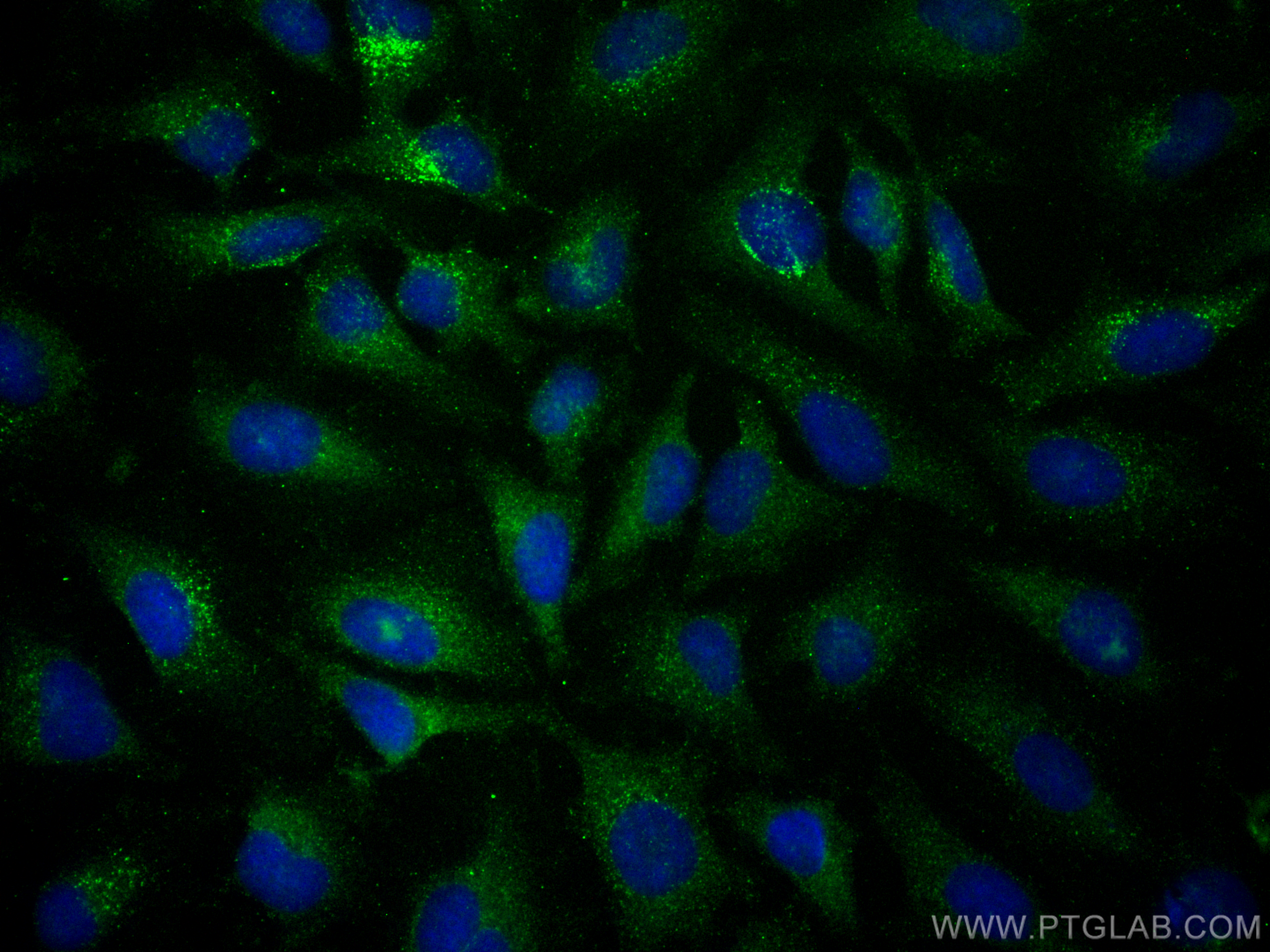 Immunofluorescence (IF) / fluorescent staining of HeLa cells using FITC Plus-conjugated TSG101 Monoclonal antibody (FITC-67381)