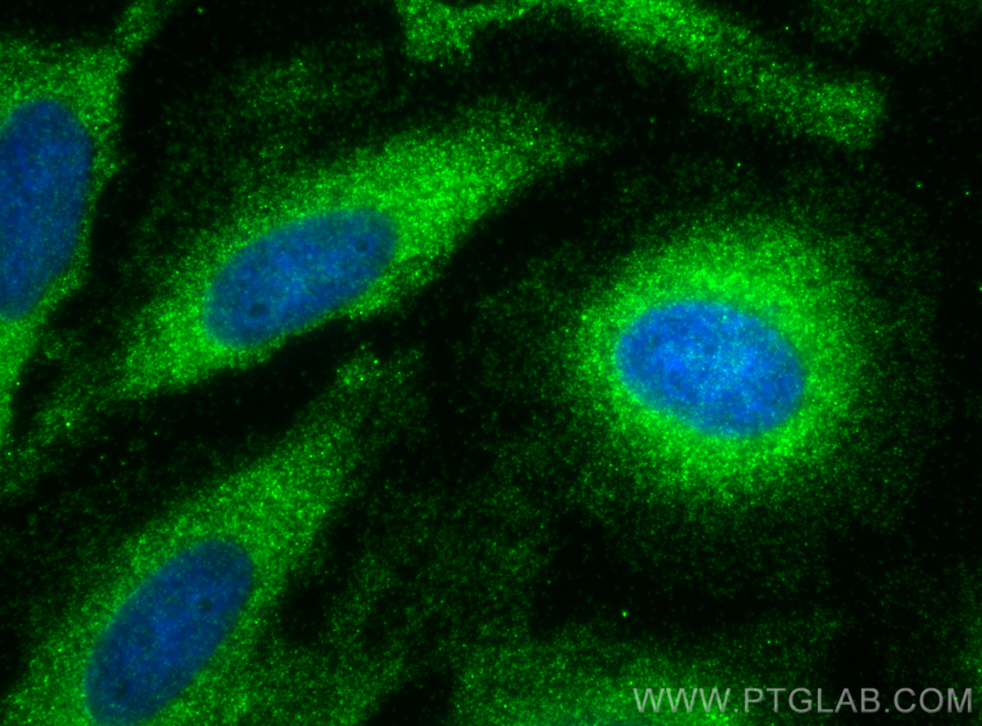 Immunofluorescence (IF) / fluorescent staining of HeLa cells using Multi-rAb™ TSG101 Multi-Recombinant antibody (RMX00026)