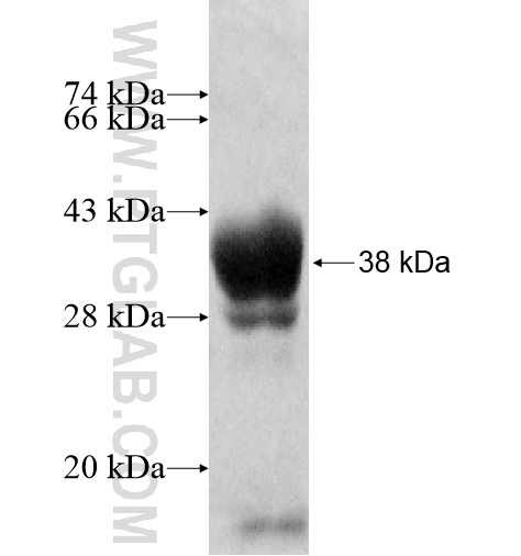 TSGA13 fusion protein Ag11321 SDS-PAGE