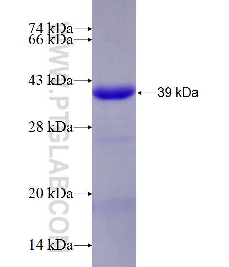 TSGA14 fusion protein Ag11861 SDS-PAGE