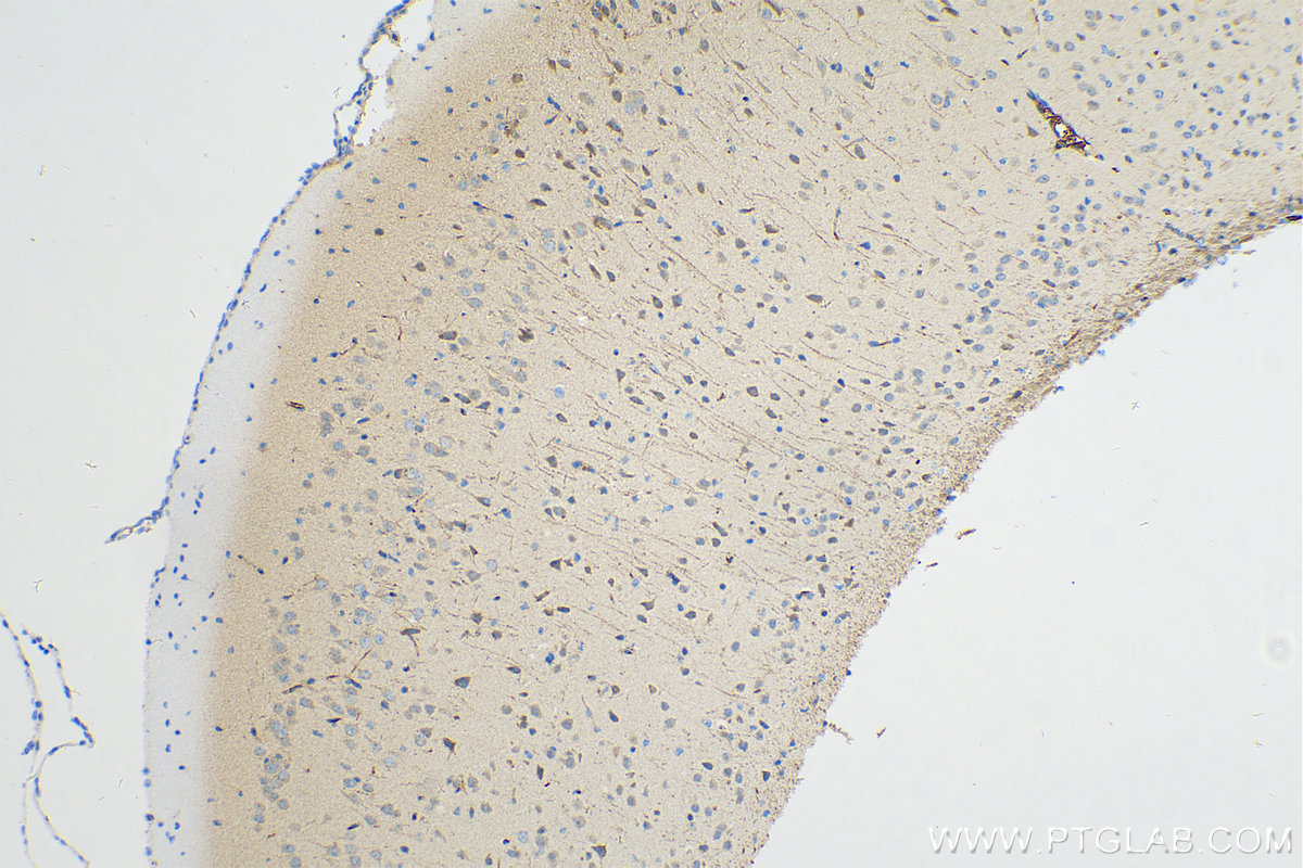 Immunohistochemistry (IHC) staining of mouse brain tissue using TSNARE1 Polyclonal antibody (24084-1-AP)