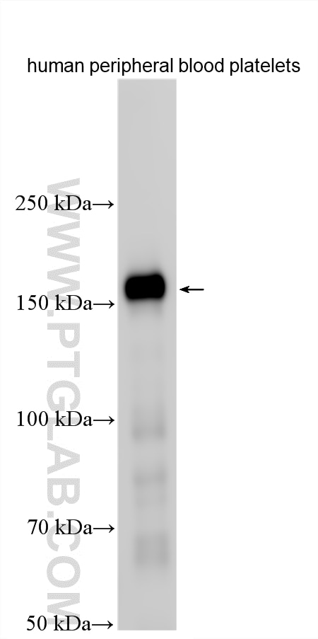 Western Blot (WB) analysis of various lysates using Thrombospondin 1 Polyclonal antibody (18304-1-AP)