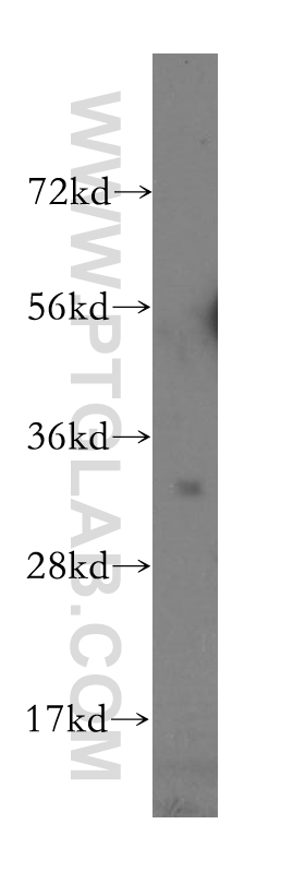 Western Blot (WB) analysis of human ovary cancer cells using TSPAN15 Polyclonal antibody (10460-1-AP)