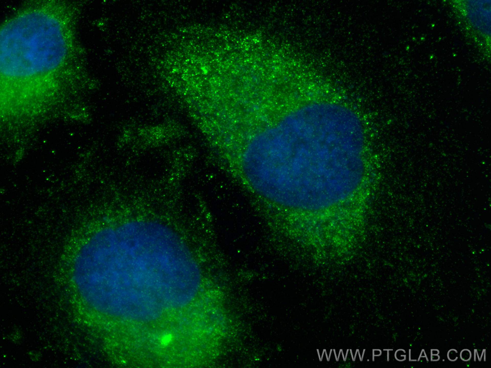 Immunofluorescence (IF) / fluorescent staining of HeLa cells using TSPAN3 Polyclonal antibody (13036-1-AP)