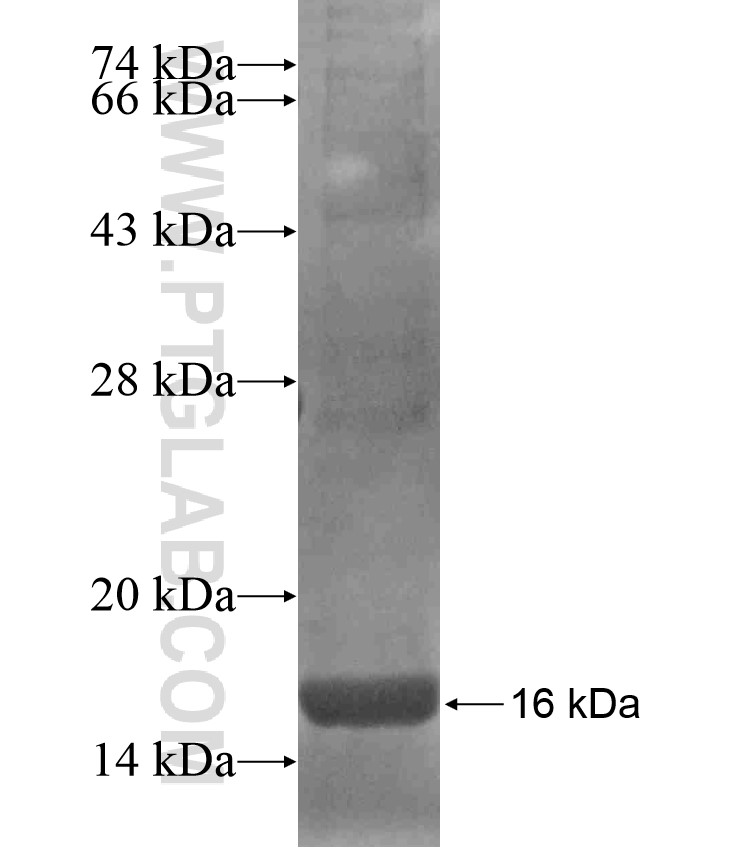 TSPAN31 fusion protein Ag17628 SDS-PAGE