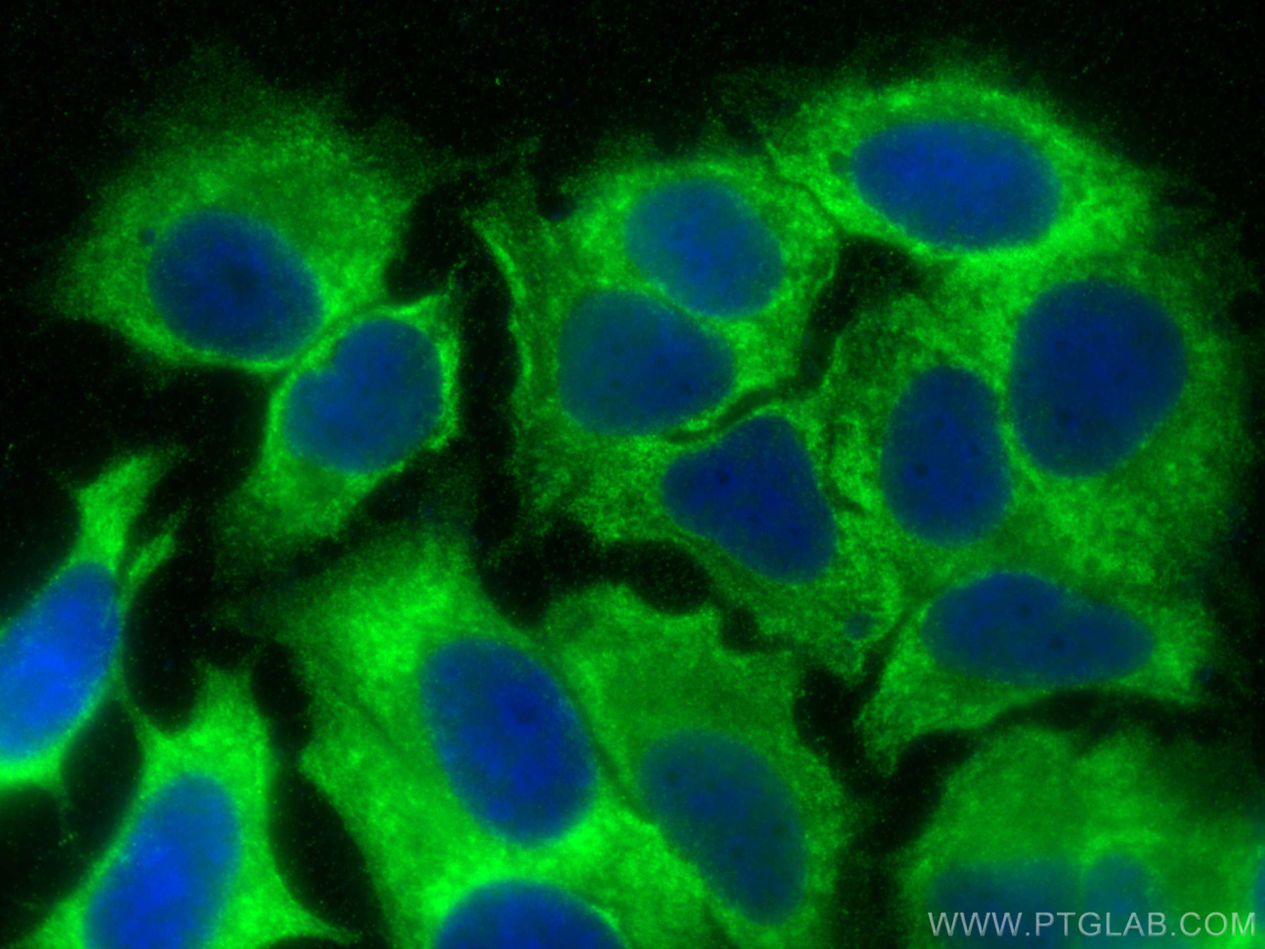 Immunofluorescence (IF) / fluorescent staining of MCF-7 cells using TSR2 Polyclonal antibody (16263-1-AP)