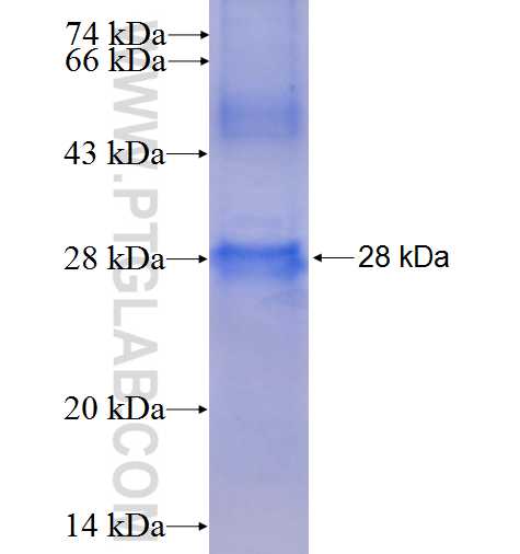 TSSK2 fusion protein Ag5162 SDS-PAGE