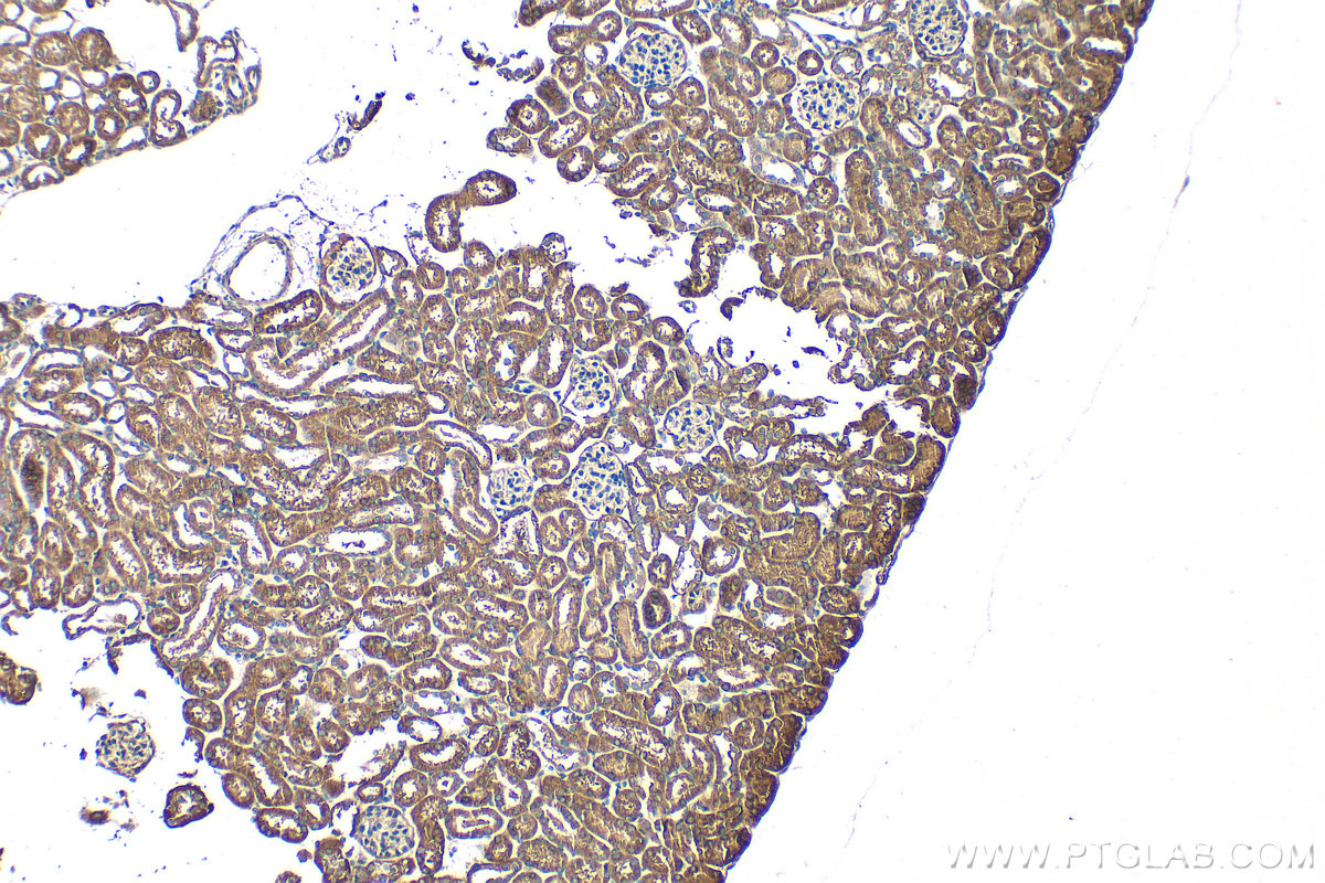 Immunohistochemistry (IHC) staining of mouse kidney tissue using TST Polyclonal antibody (16311-1-AP)