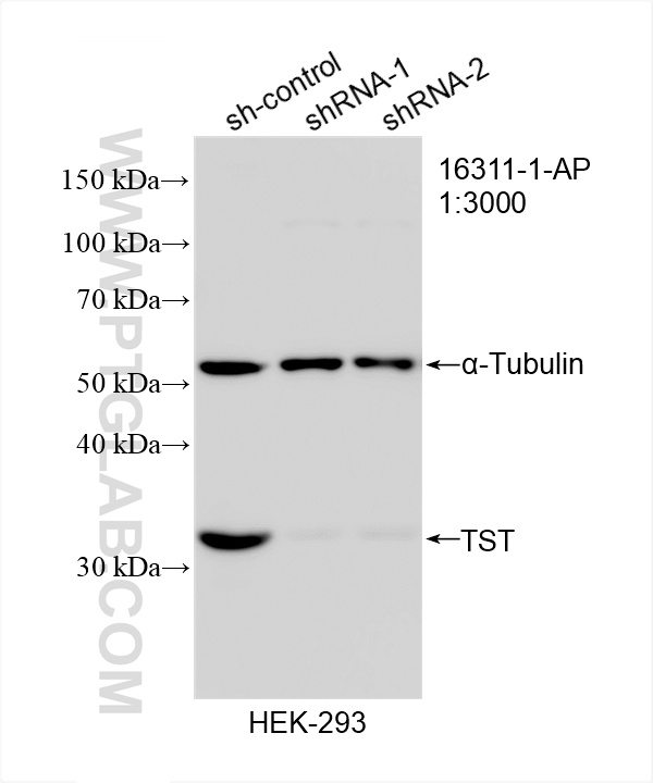 Western Blot (WB) analysis of HEK-293 cells using TST Polyclonal antibody (16311-1-AP)