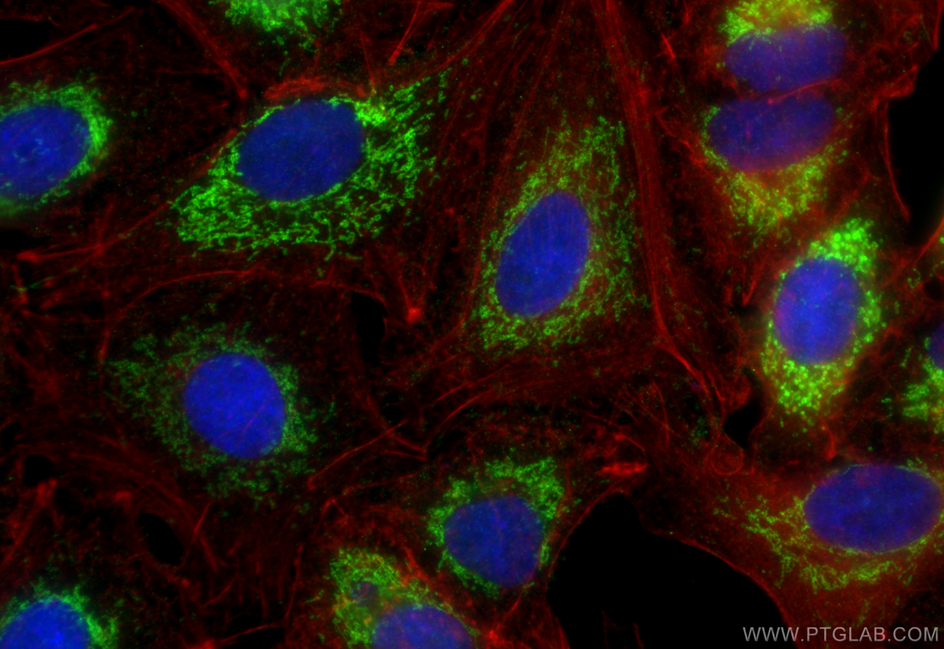 Immunofluorescence (IF) / fluorescent staining of A549 cells using TST Monoclonal antibody (66018-1-Ig)