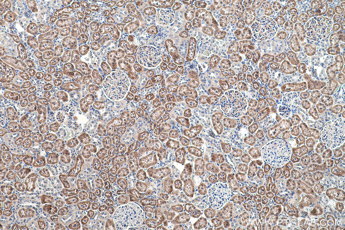 Immunohistochemistry (IHC) staining of rat kidney tissue using TST Monoclonal antibody (66018-1-Ig)