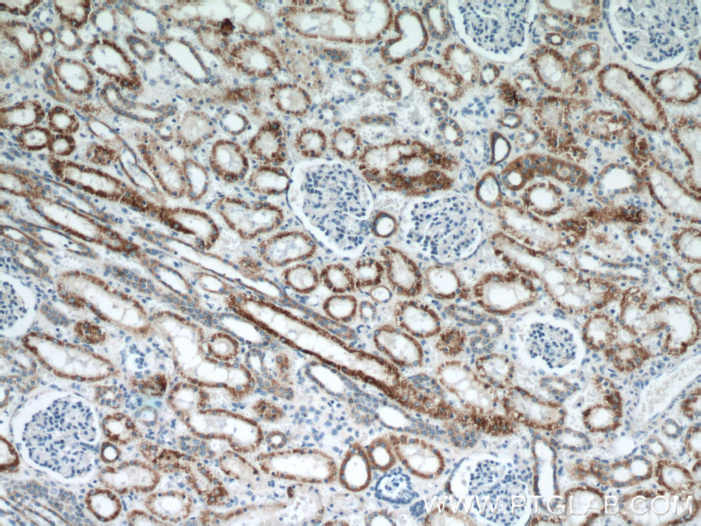 Immunohistochemistry (IHC) staining of human kidney tissue using TST Monoclonal antibody (66018-1-Ig)