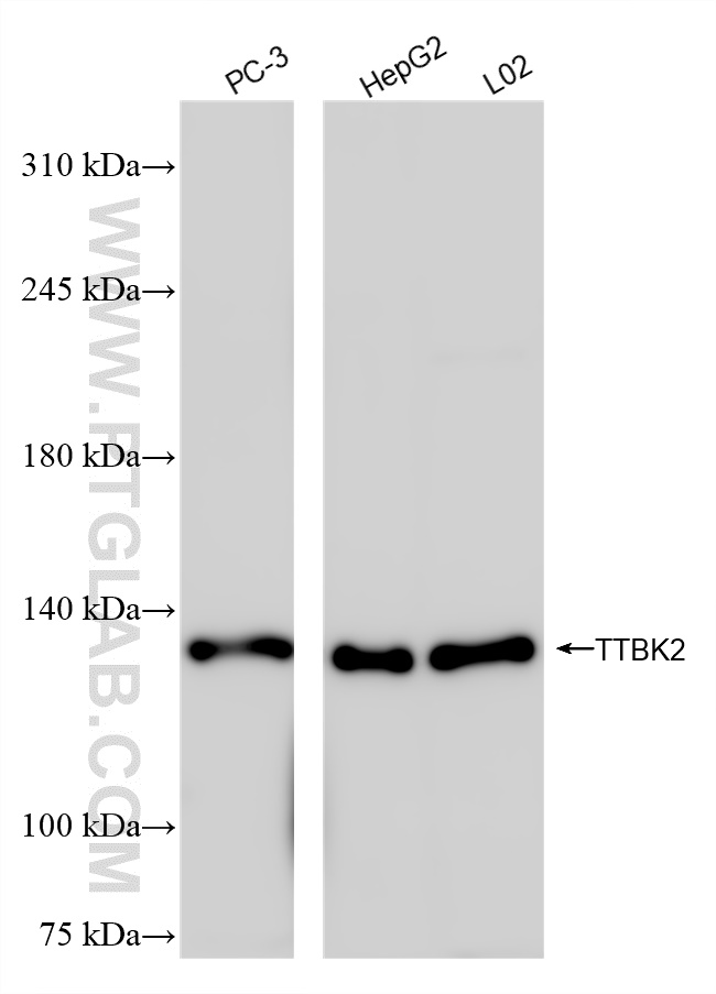 Western Blot (WB) analysis of various lysates using TTBK2 Recombinant antibody (84634-1-RR)