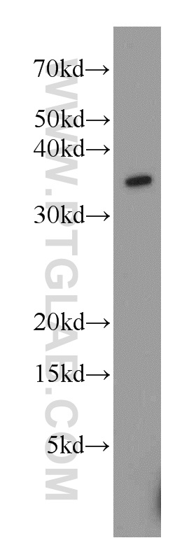 Western Blot (WB) analysis of Jurkat cells using TTC1 Polyclonal antibody (11676-1-AP)