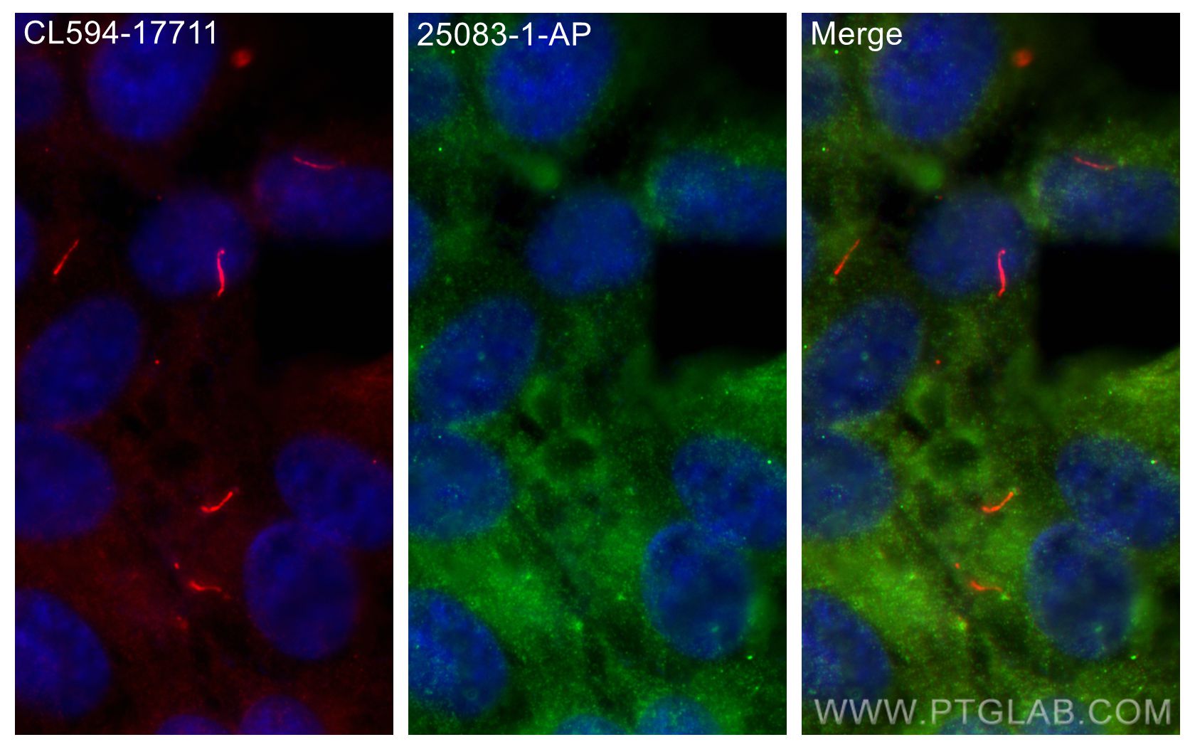 Immunofluorescence (IF) / fluorescent staining of hTERT-RPE1 cells using TTC26 Polyclonal antibody (25083-1-AP)