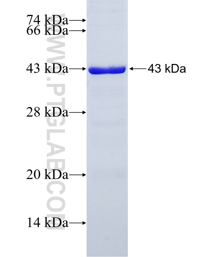 TTC28 fusion protein Ag22465 SDS-PAGE