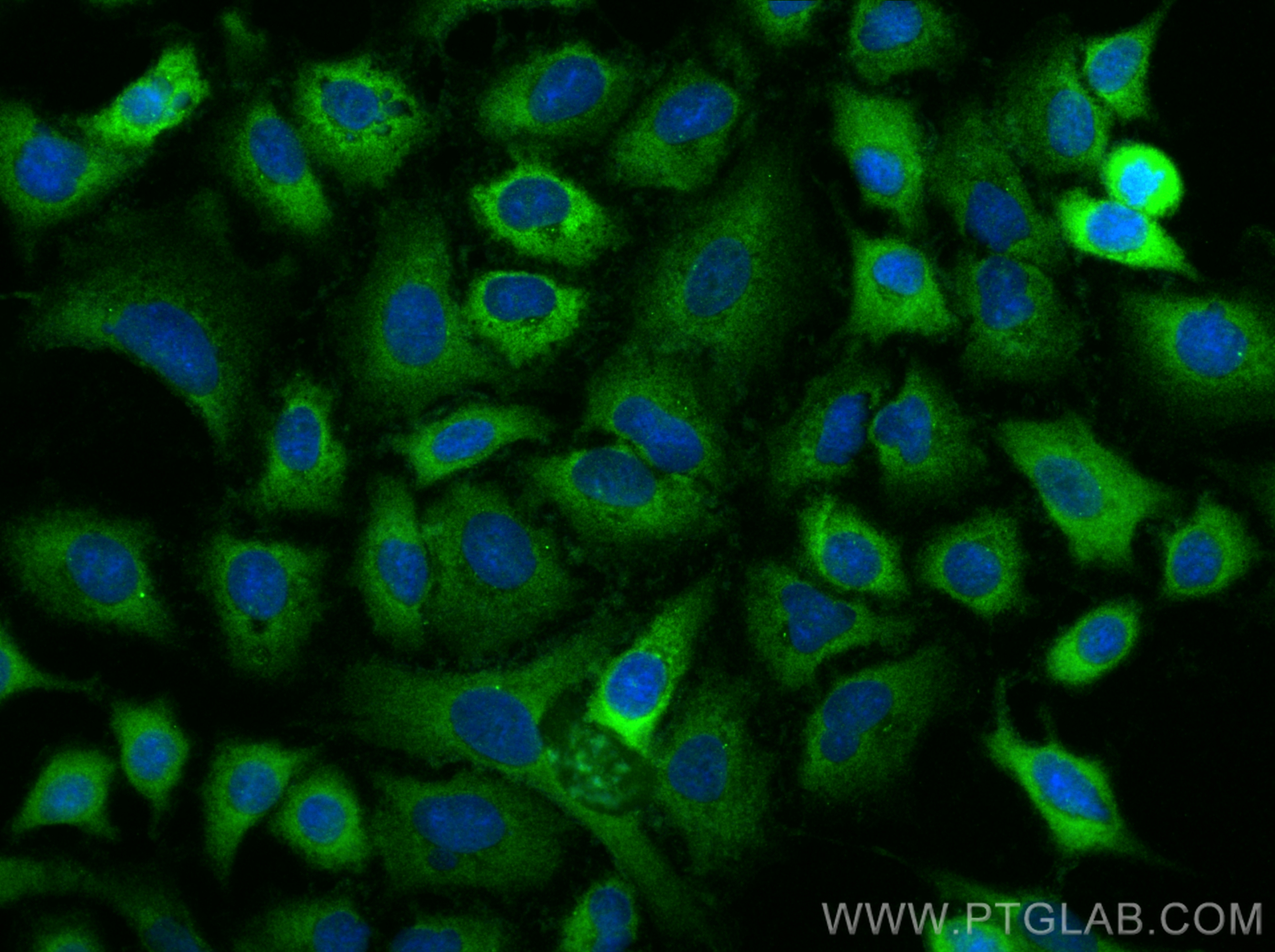 Immunofluorescence (IF) / fluorescent staining of A549 cells using TTC37 Polyclonal antibody (24594-1-AP)