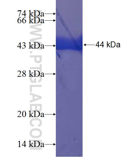 TTC5 fusion protein Ag23501 SDS-PAGE