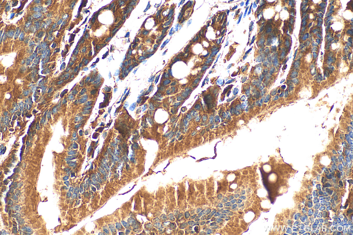 Immunohistochemistry (IHC) staining of mouse small intestine tissue using TTC7A Polyclonal antibody (21600-1-AP)