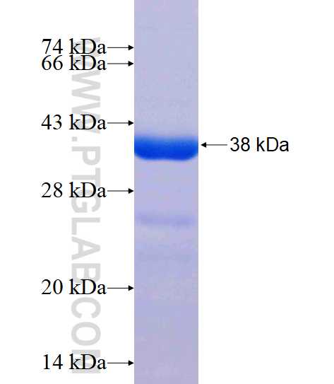 TTC7A fusion protein Ag16999 SDS-PAGE