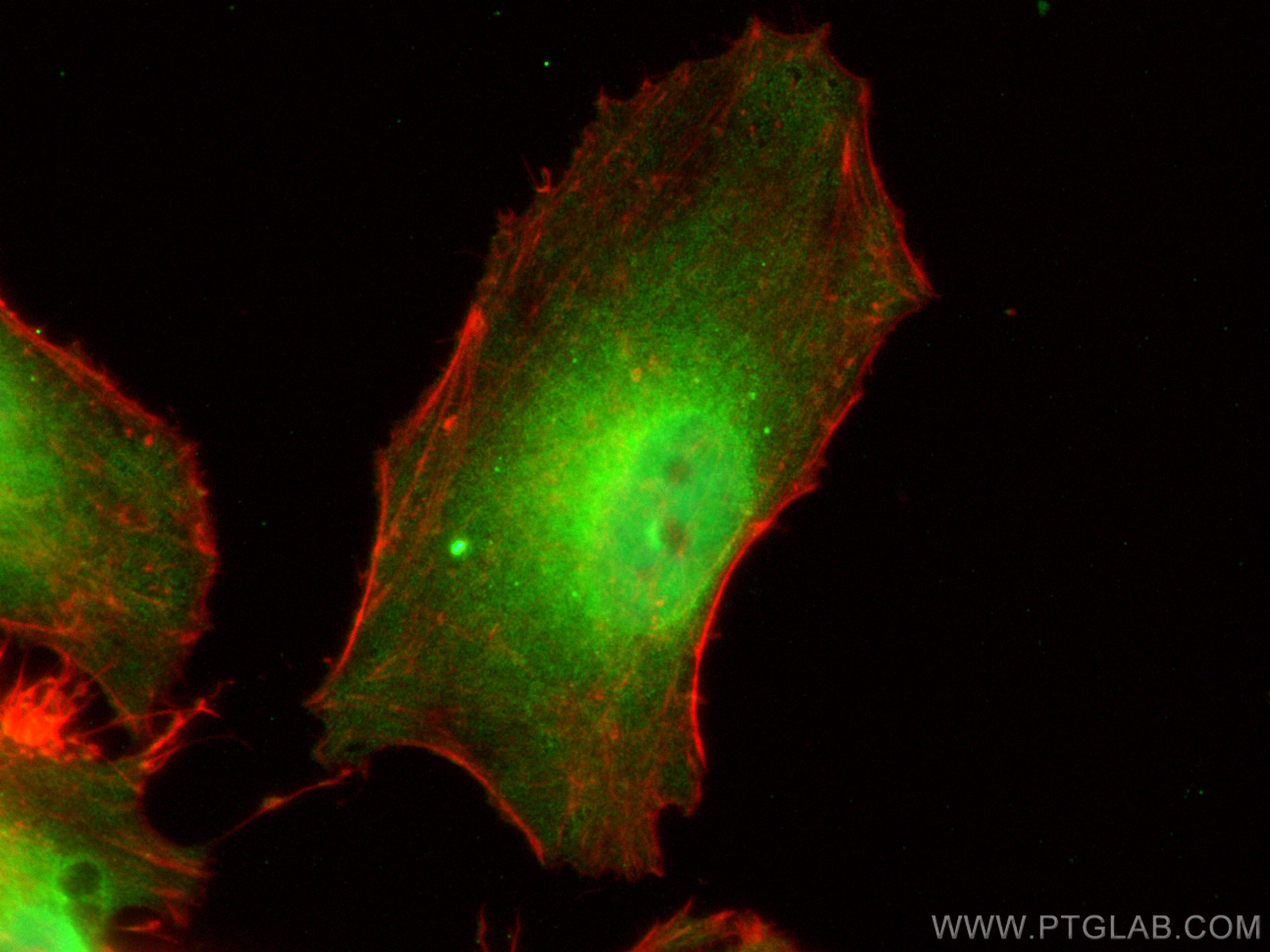 Immunofluorescence (IF) / fluorescent staining of HeLa cells using TTF2 Polyclonal antibody (13722-1-AP)