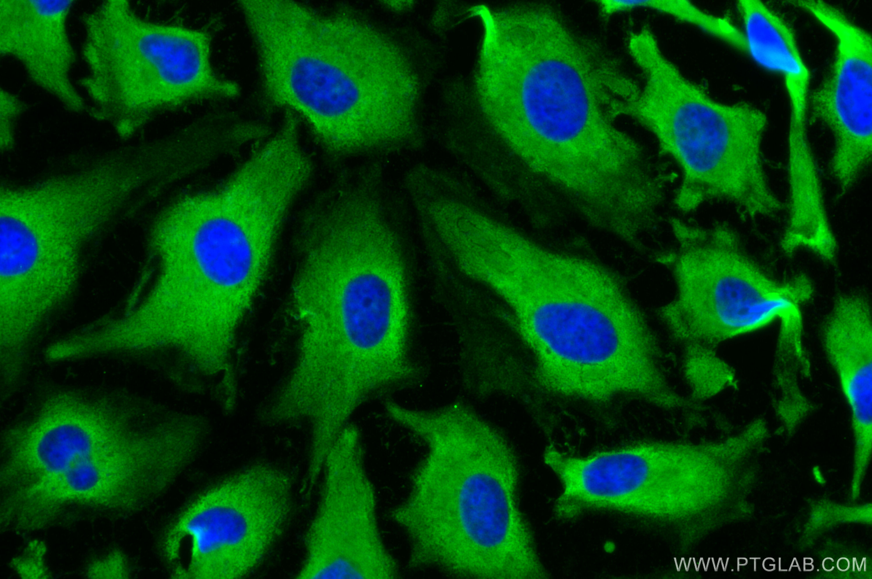 Immunofluorescence (IF) / fluorescent staining of HeLa cells using TTF2 Polyclonal antibody (13722-1-AP)