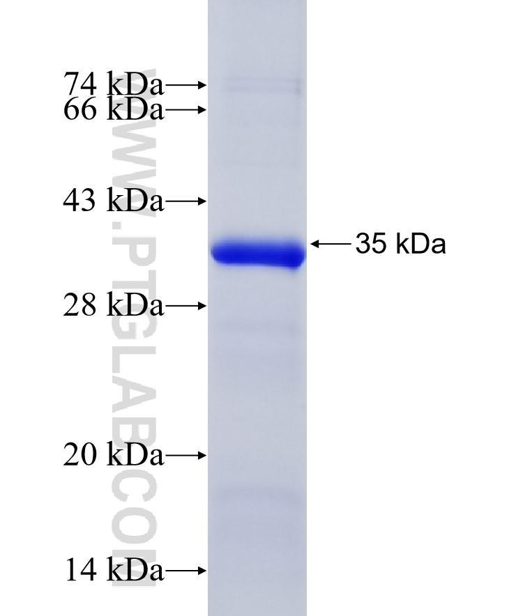 TTK fusion protein Ag20556 SDS-PAGE