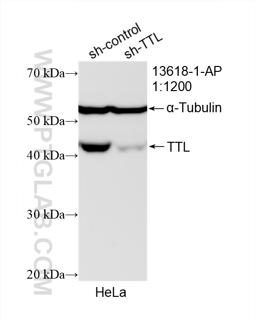 Western Blot (WB) analysis of HeLa cells using TTL Polyclonal antibody (13618-1-AP)