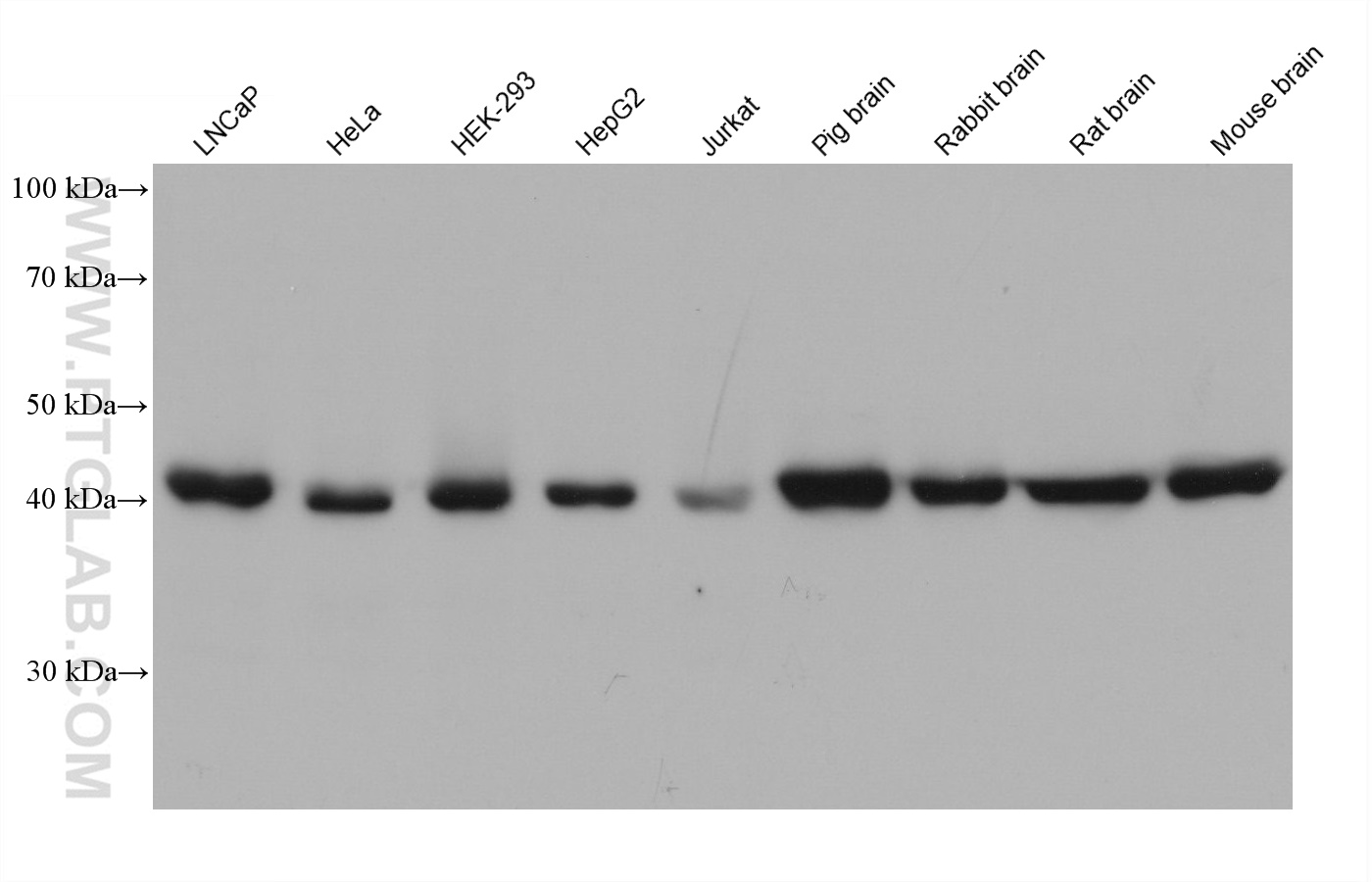 Western Blot (WB) analysis of various lysates using TTL Monoclonal antibody (66076-1-Ig)