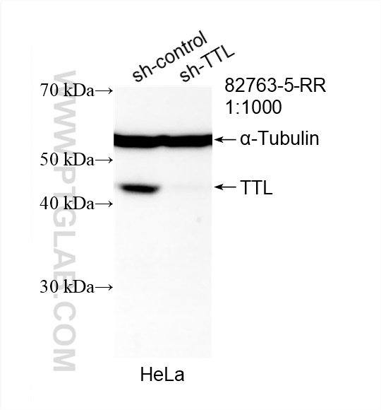Western Blot (WB) analysis of HeLa cells using TTL Recombinant antibody (82763-5-RR)