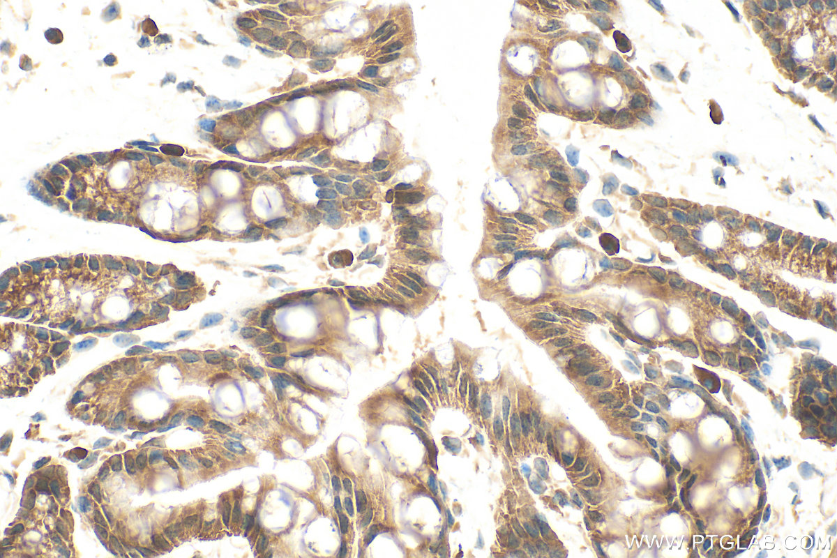 Immunohistochemistry (IHC) staining of mouse colon tissue using Prealbumin/transthyretin Polyclonal antibody (11891-1-AP)