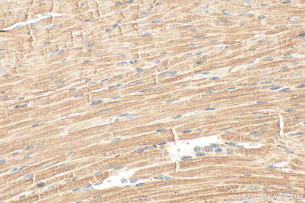 Immunohistochemistry (IHC) staining of mouse heart tissue using Prealbumin/transthyretin Polyclonal antibody (11891-1-AP)