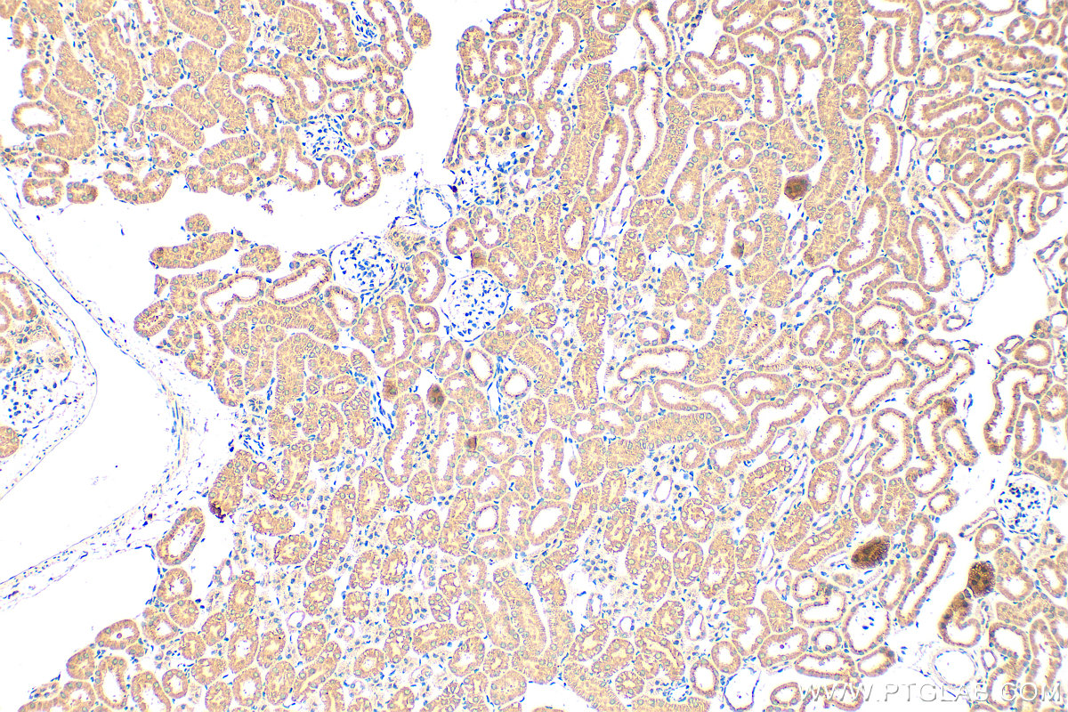 Immunohistochemistry (IHC) staining of mouse kidney tissue using Prealbumin/transthyretin Polyclonal antibody (11891-1-AP)