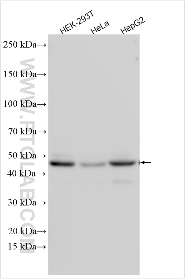 Western Blot (WB) analysis of various lysates using TTRAP Polyclonal antibody (12203-1-AP)